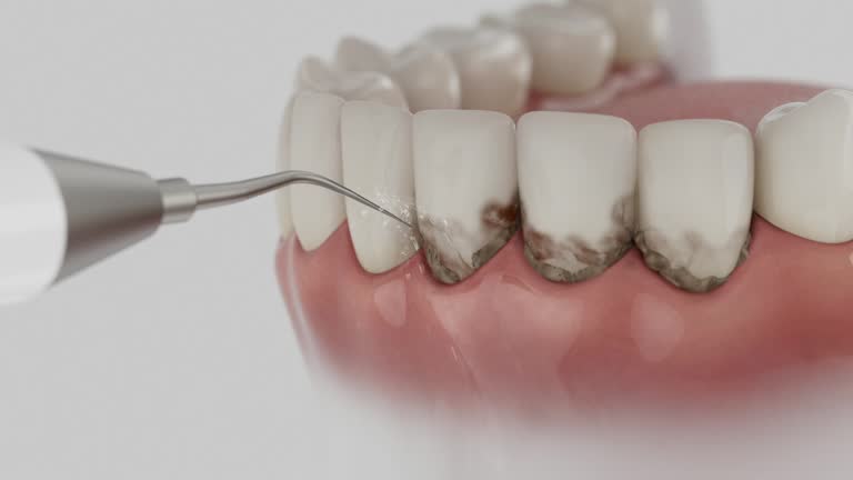 Reliable Wisdom Tooth Removal contractor in Caroline County County, MD by Dentist Open Now